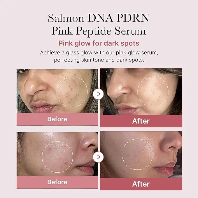 PDRN Pink Peptide Serum Kawaika shop