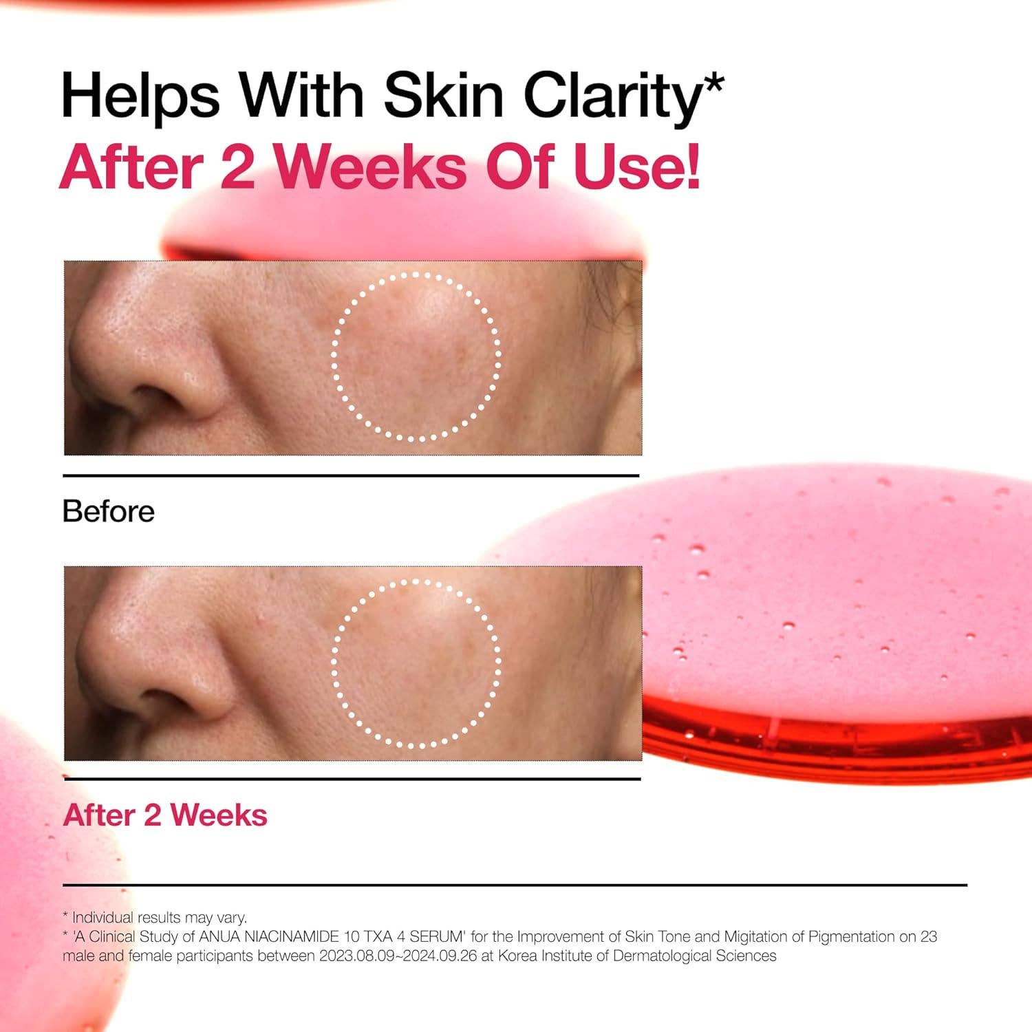 Sérum ANUA 10 % Niacinamide + 4 % Acide Tranexamique (30 ml) Glowiss