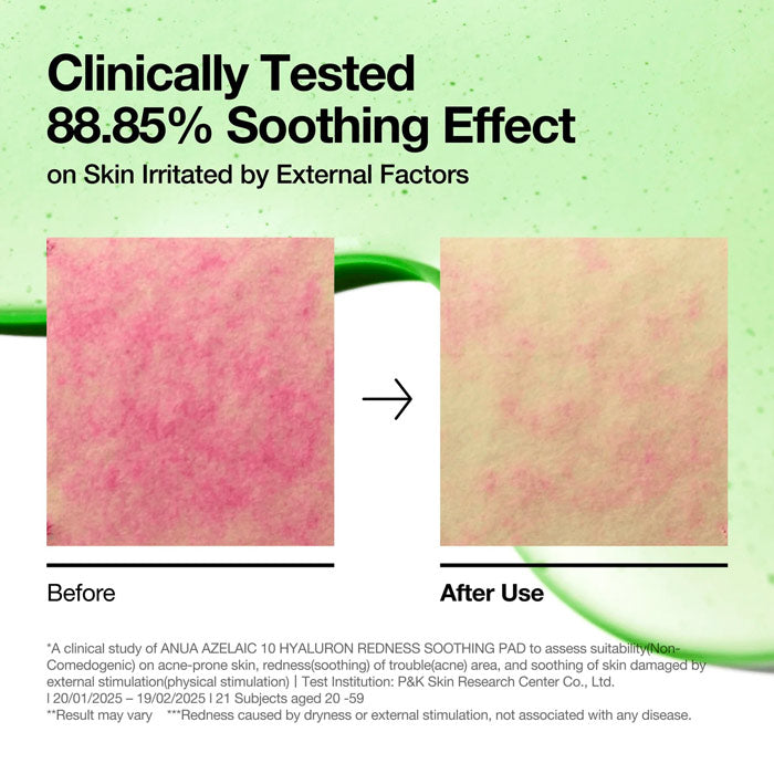 ANUA Pads Azelaic 10 + Hyaluron ANUA