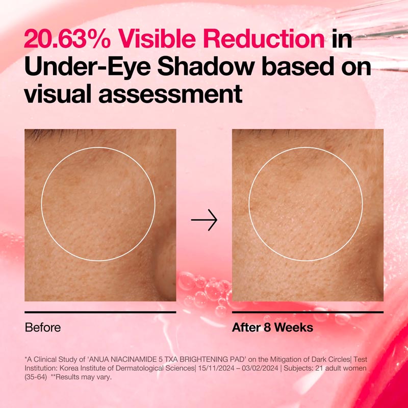 ANUA Pads Niacinamide 5 + TXA ANUA