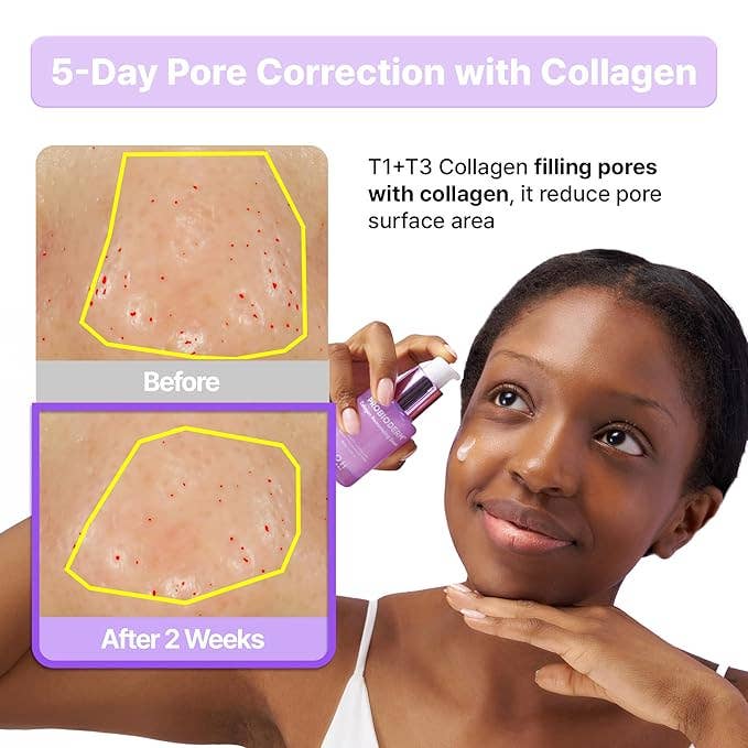 Sérum remodelant au collagène BIOHEAL BOH Probioderm™ 1,01 fl oz (30 ml) Glowiss